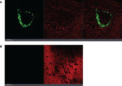 Re-introduction of a bioactive bacterial endophyte back to its seaweed (Ulva sp.) host, influences the host’s microbiome